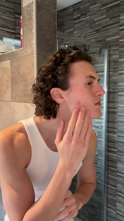 Story Video for PIMPLE PATCH