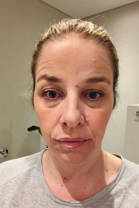 Story Cover - Revitalif Eye bag eraser